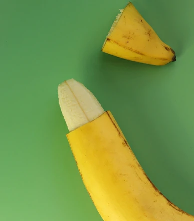 Circuncisión urólogo Dr. Orlando José Hernández