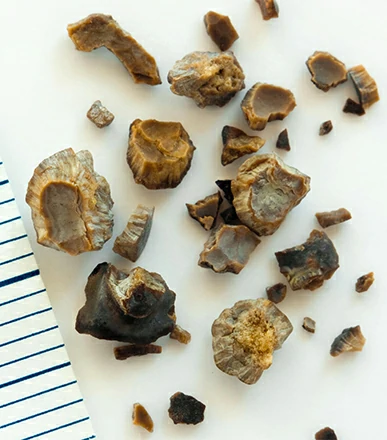 Cálculos renales y vías urinarias