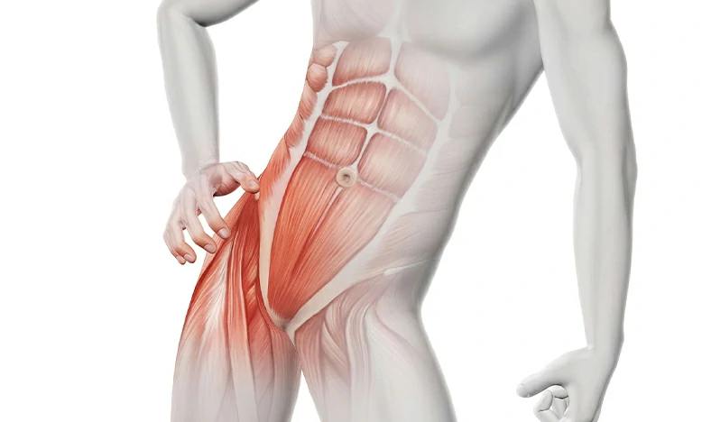 Hernia inguinal síntomas