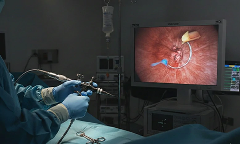 Resección transuretral bipolar de próstata RTUP