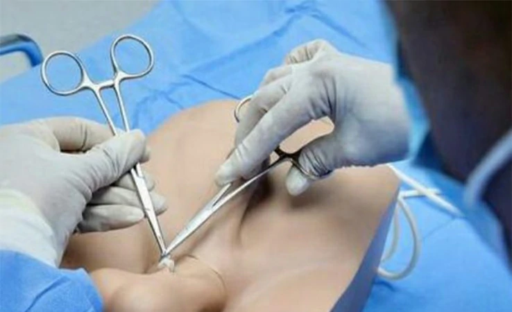 Vasectomía reversión