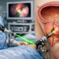 prostata laser naucalpan con tecnica holep featured 85x85