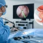 especialistas en cirugia de prostata con laser featured 85x85